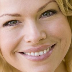 blanqueamiento dental en Badalona